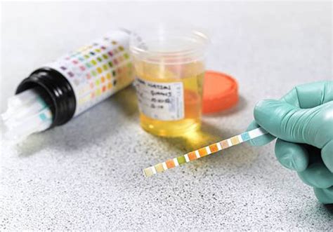 Iloilo City cop intel operatives undergo drug testing .